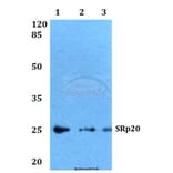 Anti-SRp20 (F151) Antibody from Bioworld Technology (BS2559) - Antibodies.com