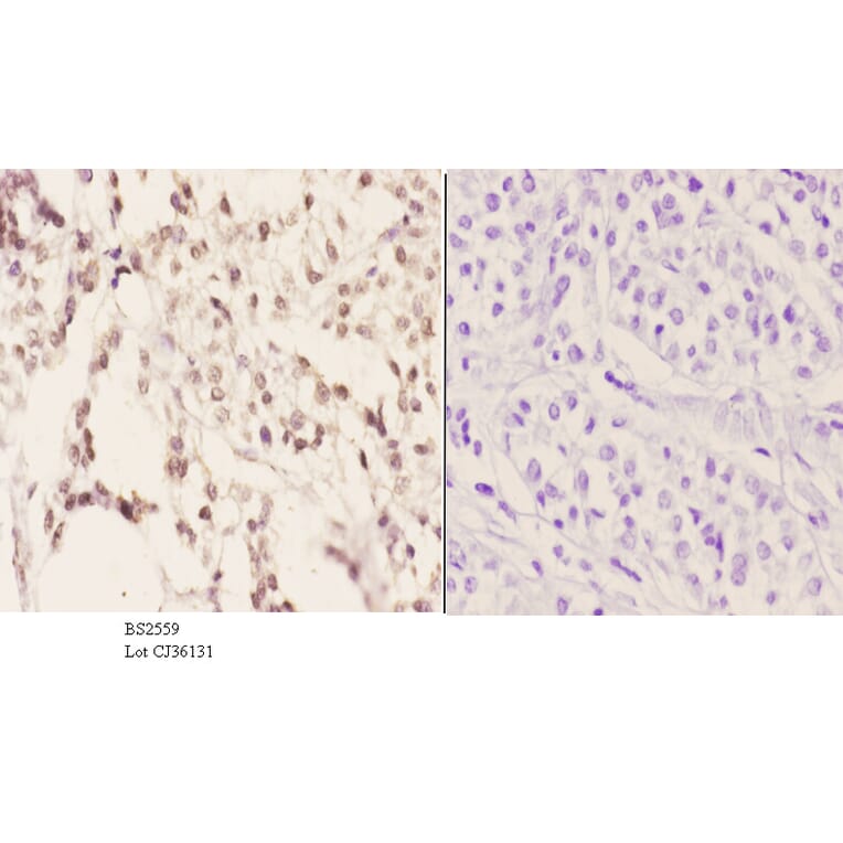 Anti-SRp20 (F151) Antibody from Bioworld Technology (BS2559) - Antibodies.com