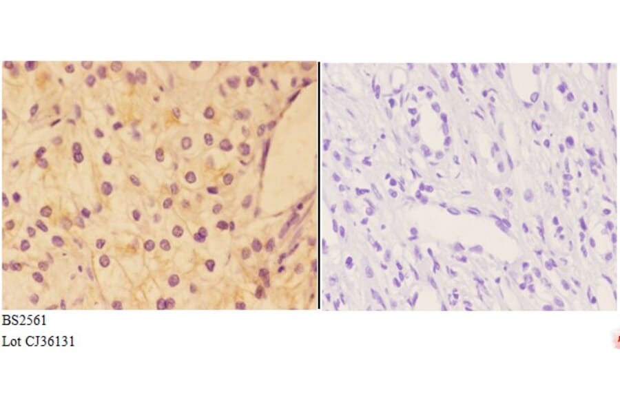 Anti-AKAP 13 (D738) Antibody from Bioworld Technology (BS2561) - Antibodies.com