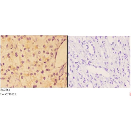 Anti-AKAP 13 (D738) Antibody from Bioworld Technology (BS2561) - Antibodies.com