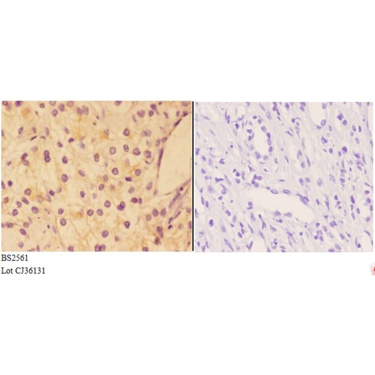 Anti-AKAP 13 (D738) Antibody from Bioworld Technology (BS2561) - Antibodies.com