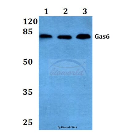 Anti-Gas6 (G309) Antibody from Bioworld Technology (BS2563) - Antibodies.com