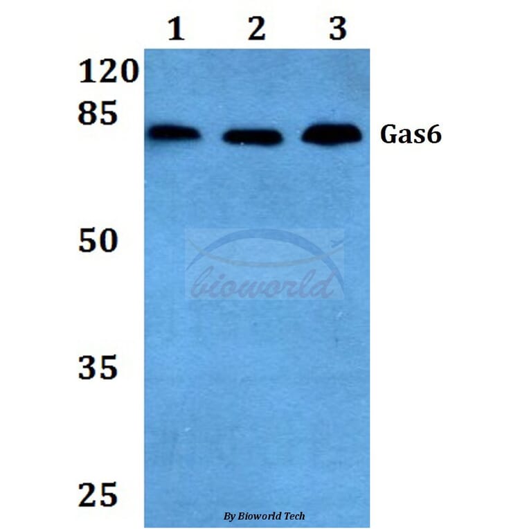 Anti-Gas6 (G309) Antibody from Bioworld Technology (BS2563) - Antibodies.com