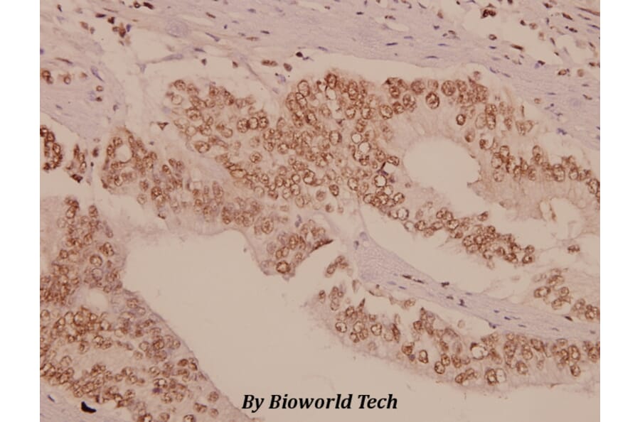 Anti-Gas6 (G309) Antibody from Bioworld Technology (BS2563) - Antibodies.com