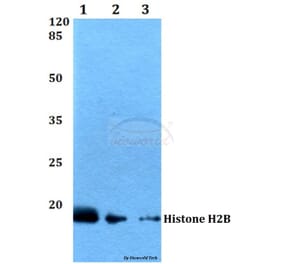 Anti-Histone H2B (K24) Antibody from Bioworld Technology (BS2568) - Antibodies.com