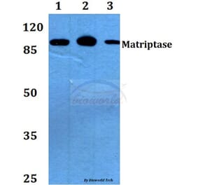 Anti-Matriptase (K21) Antibody from Bioworld Technology (BS2574) - Antibodies.com