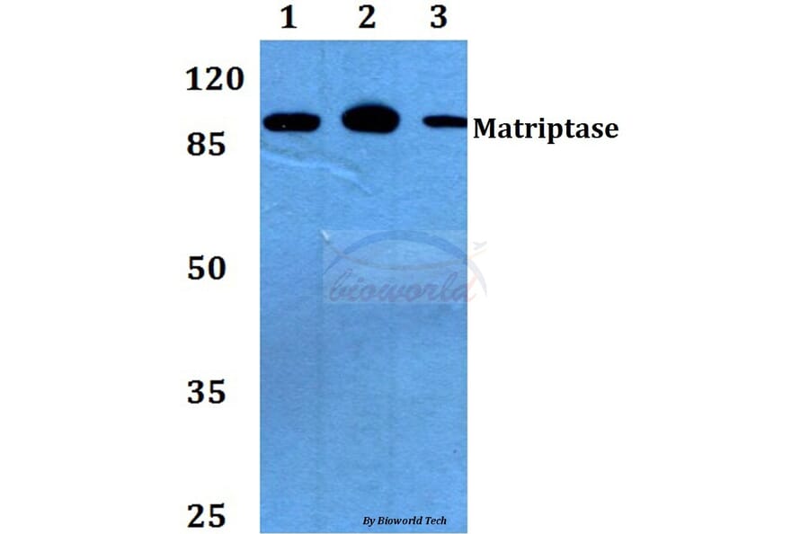 Anti-Matriptase (K21) Antibody from Bioworld Technology (BS2574) - Antibodies.com