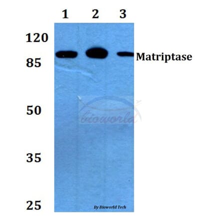 Anti-Matriptase (K21) Antibody from Bioworld Technology (BS2574) - Antibodies.com