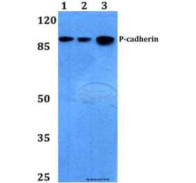 Anti-P-Cadherin (G78) Antibody from Bioworld Technology (BS2577) - Antibodies.com