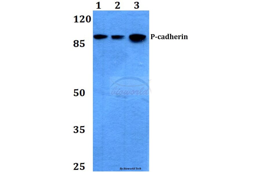 Anti-P-Cadherin (G78) Antibody from Bioworld Technology (BS2577) - Antibodies.com