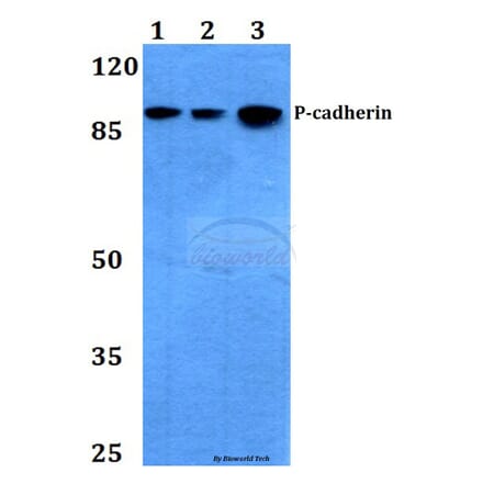 Anti-P-Cadherin (G78) Antibody from Bioworld Technology (BS2577) - Antibodies.com