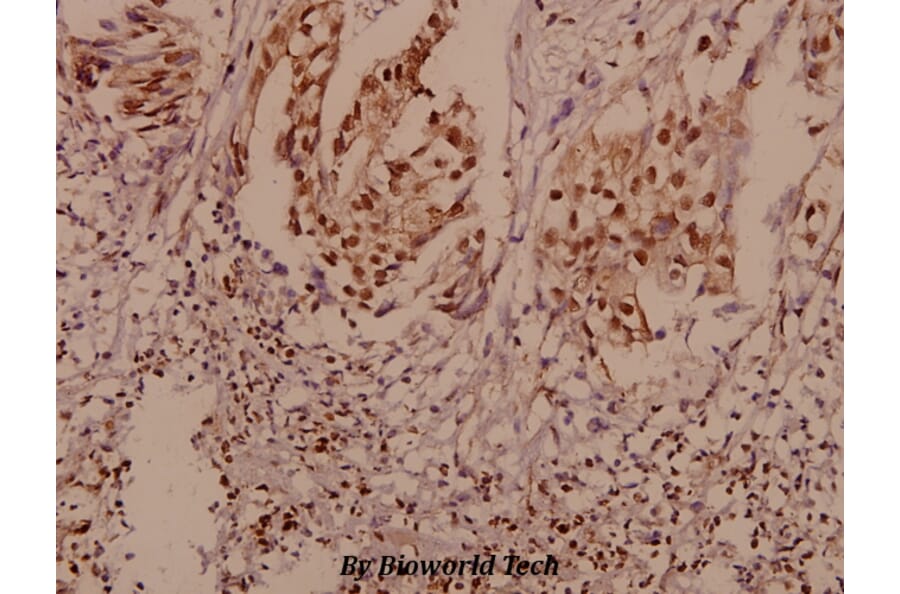 Anti-P-Cadherin (G78) Antibody from Bioworld Technology (BS2577) - Antibodies.com
