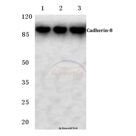 Anti-Cadherin-8 (A519) Antibody from Bioworld Technology (BS2578) - Antibodies.com