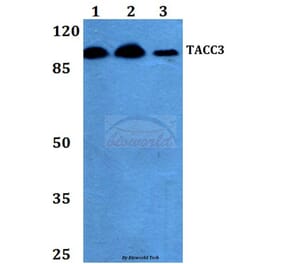 Anti-TACC3 (T813) Antibody from Bioworld Technology (BS2580) - Antibodies.com