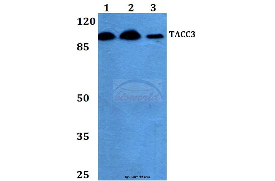 Anti-TACC3 (T813) Antibody from Bioworld Technology (BS2580) - Antibodies.com