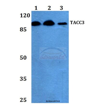 Anti-TACC3 (T813) Antibody from Bioworld Technology (BS2580) - Antibodies.com