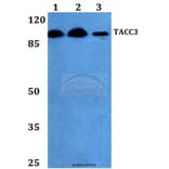 Anti-TACC3 (T813) Antibody from Bioworld Technology (BS2580) - Antibodies.com