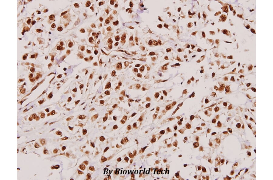 Anti-TACC3 (T813) Antibody from Bioworld Technology (BS2580) - Antibodies.com