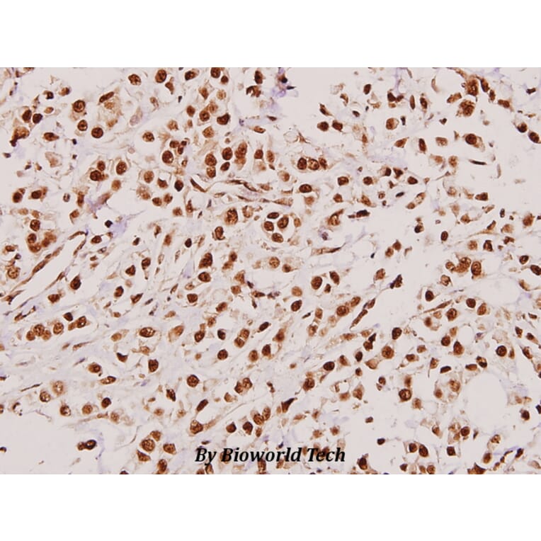 Anti-TACC3 (T813) Antibody from Bioworld Technology (BS2580) - Antibodies.com