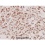 Anti-TACC3 (T813) Antibody from Bioworld Technology (BS2580) - Antibodies.com