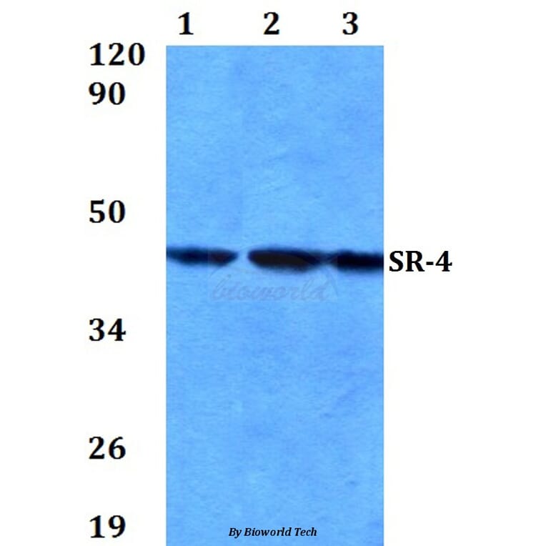 Anti-SR-4 (N180) Antibody from Bioworld Technology (BS2582) - Antibodies.com