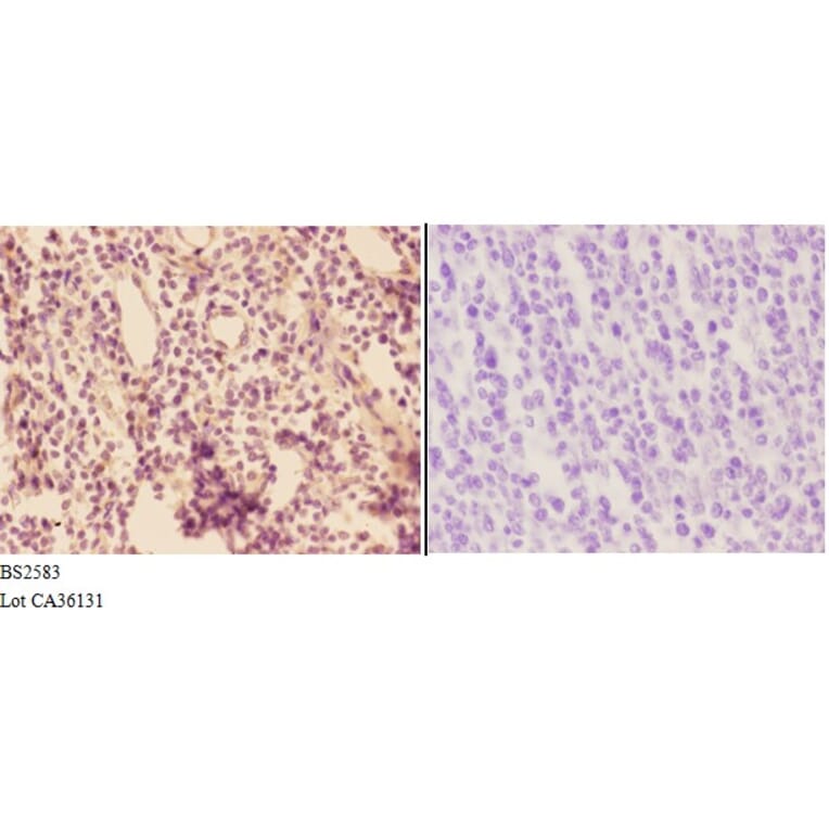 Anti-ADORA3 (E318) Antibody from Bioworld Technology (BS2583) - Antibodies.com