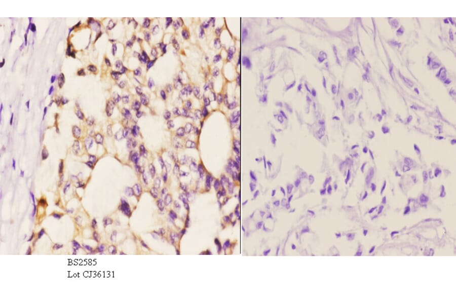 Anti-AR-β2 (C378) Antibody from Bioworld Technology (BS2585) - Antibodies.com