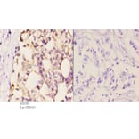 Anti-AR-β2 (C378) Antibody from Bioworld Technology (BS2585) - Antibodies.com