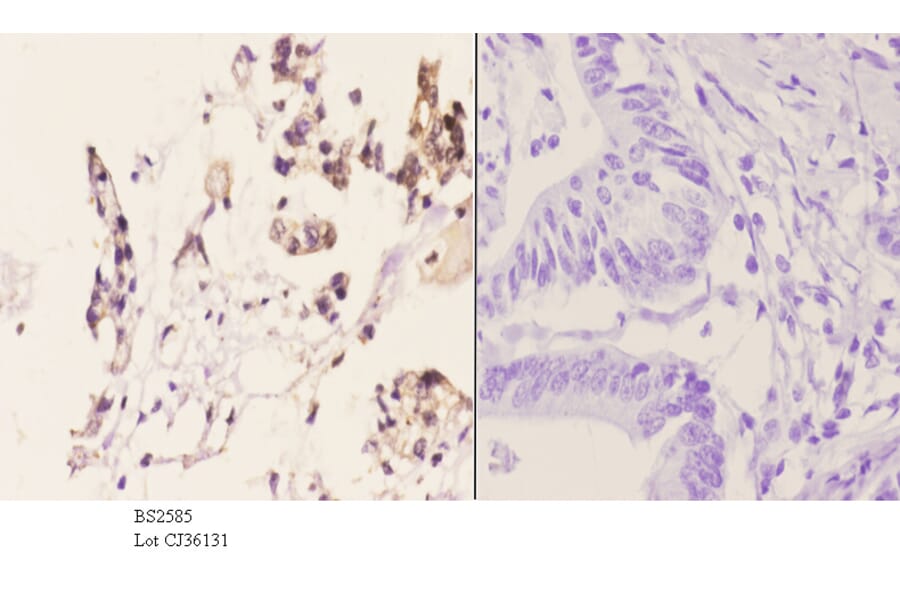 Anti-AR-β2 (C378) Antibody from Bioworld Technology (BS2585) - Antibodies.com