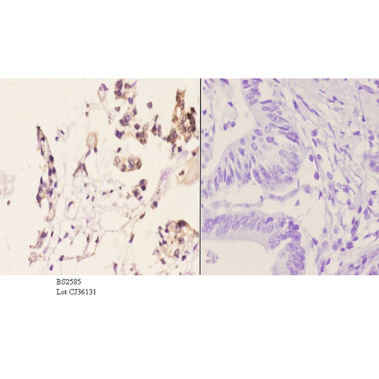 Anti-AR-β2 (C378) Antibody from Bioworld Technology (BS2585) - Antibodies.com