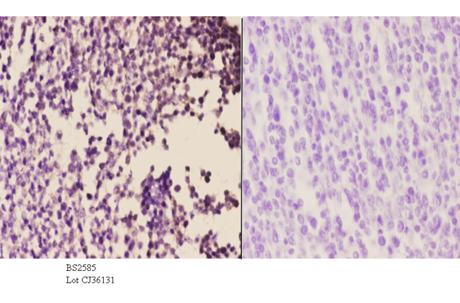 Anti-AR-β2 (C378) Antibody from Bioworld Technology (BS2585) - Antibodies.com