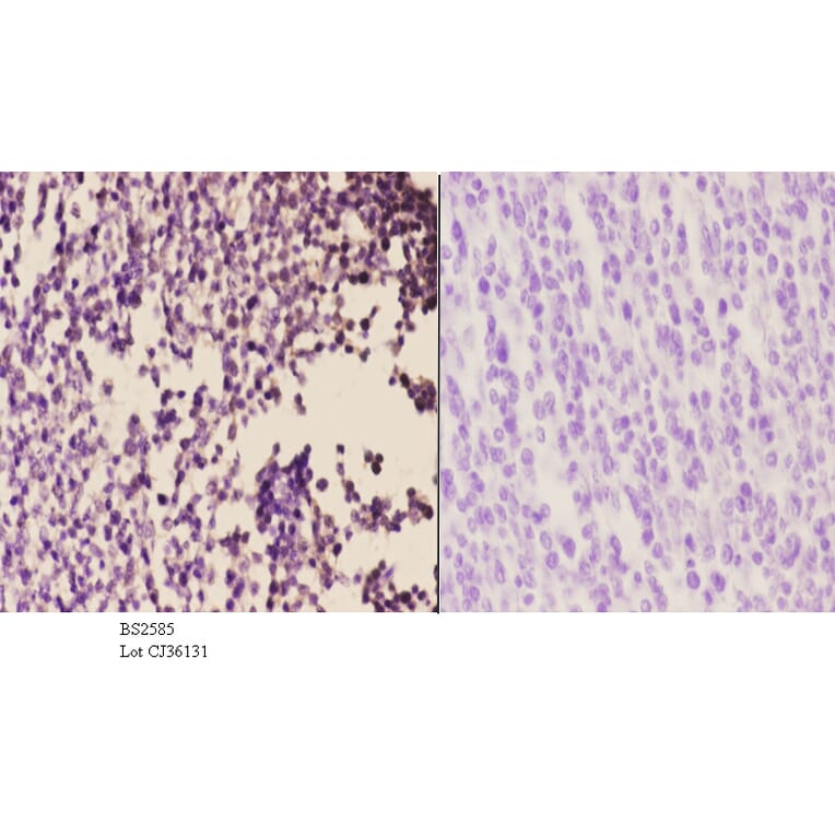 Anti-AR-β2 (C378) Antibody from Bioworld Technology (BS2585) - Antibodies.com