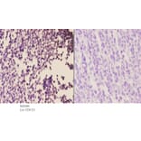 Anti-AR-β2 (C378) Antibody from Bioworld Technology (BS2585) - Antibodies.com