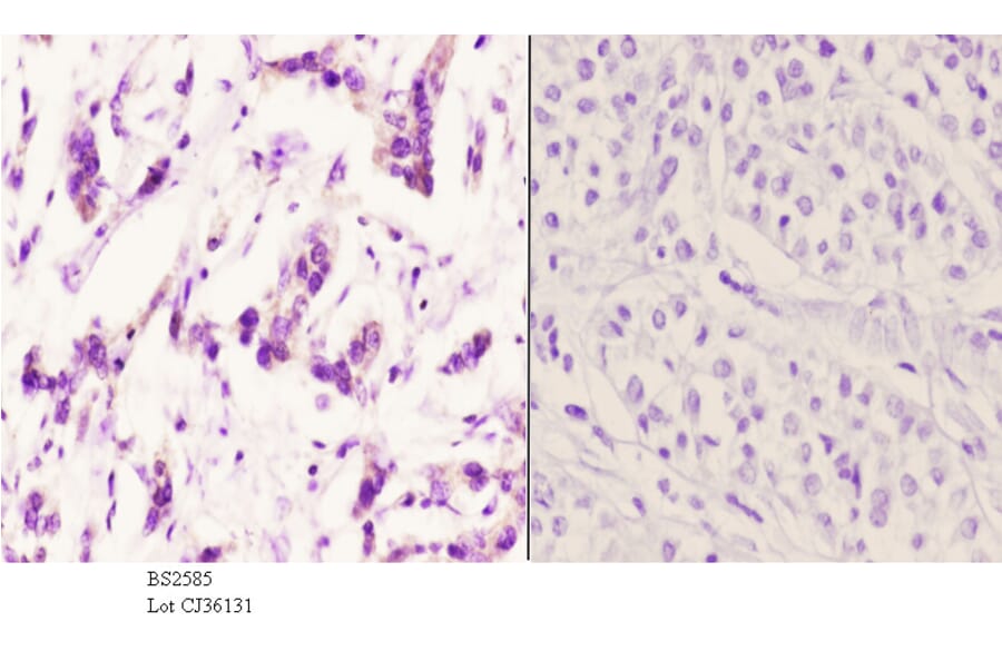 Anti-AR-β2 (C378) Antibody from Bioworld Technology (BS2585) - Antibodies.com