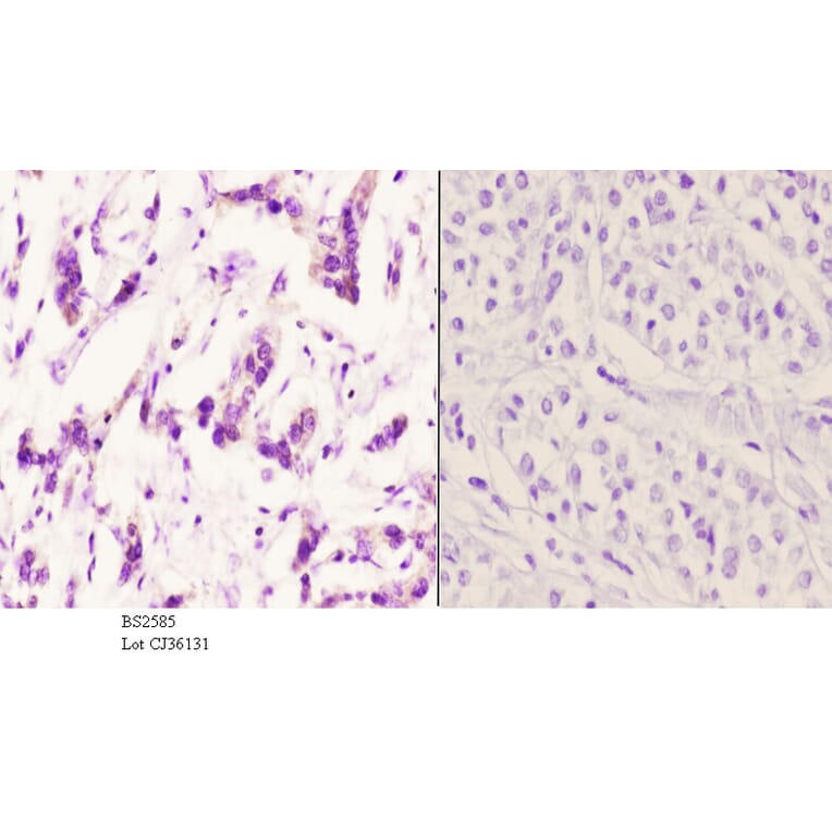 Anti-AR-β2 (C378) Antibody from Bioworld Technology (BS2585) - Antibodies.com
