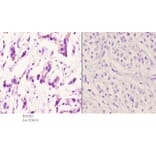 Anti-AR-β2 (C378) Antibody from Bioworld Technology (BS2585) - Antibodies.com