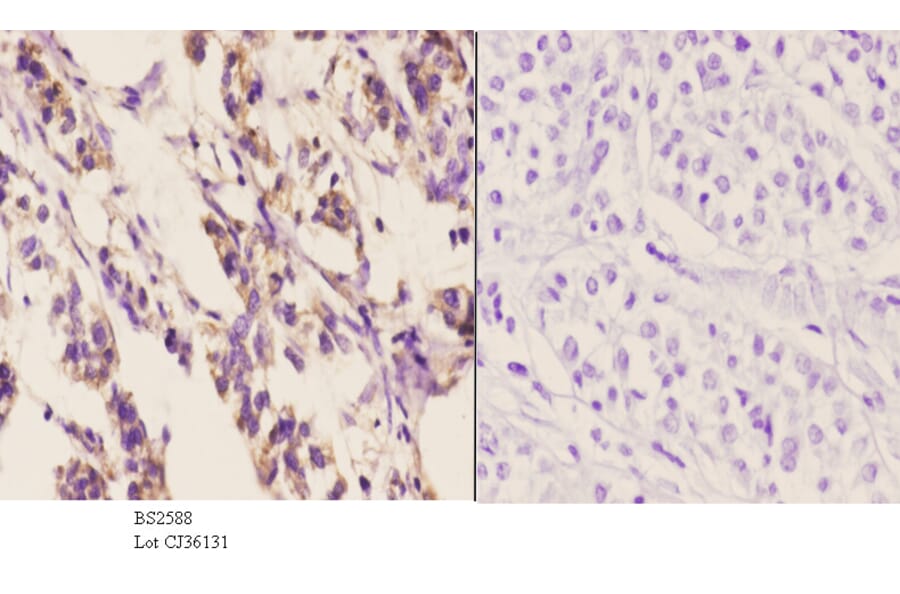 Anti-Chemokine Receptor D6 Antibody from Bioworld Technology (BS2588) - Antibodies.com