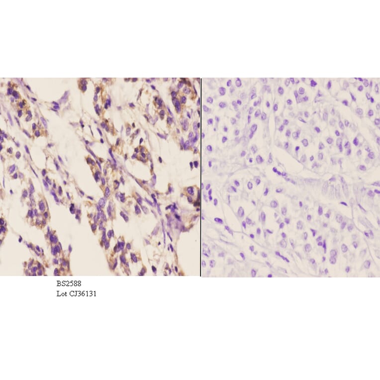 Anti-Chemokine Receptor D6 Antibody from Bioworld Technology (BS2588) - Antibodies.com