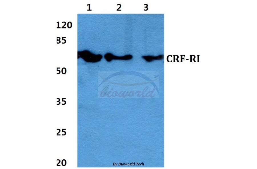 Anti-CRF-RI (H177) Antibody from Bioworld Technology (BS2590) - Antibodies.com
