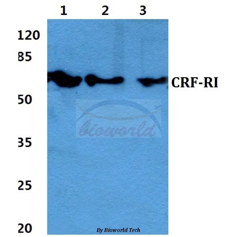 Anti-CRF-RI (H177) Antibody from Bioworld Technology (BS2590) - Antibodies.com