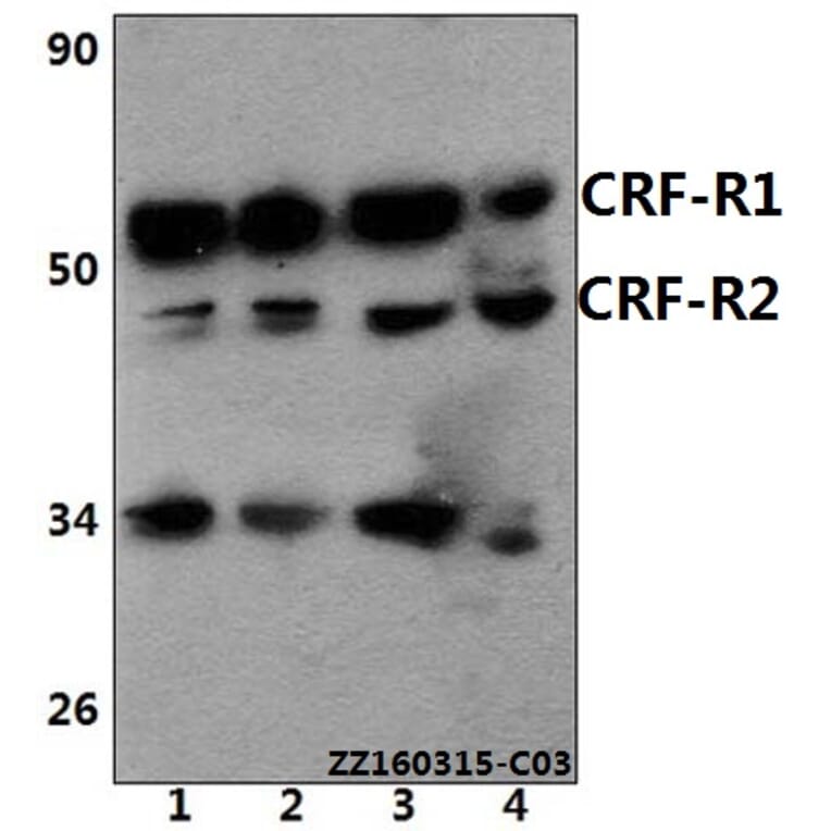 Anti-CRF-RI (H177) Antibody from Bioworld Technology (BS2590) - Antibodies.com