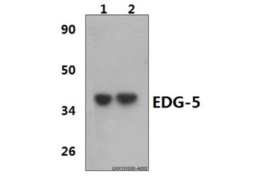 Anti-EDG-5 (L303) Antibody from Bioworld Technology (BS2594) - Antibodies.com