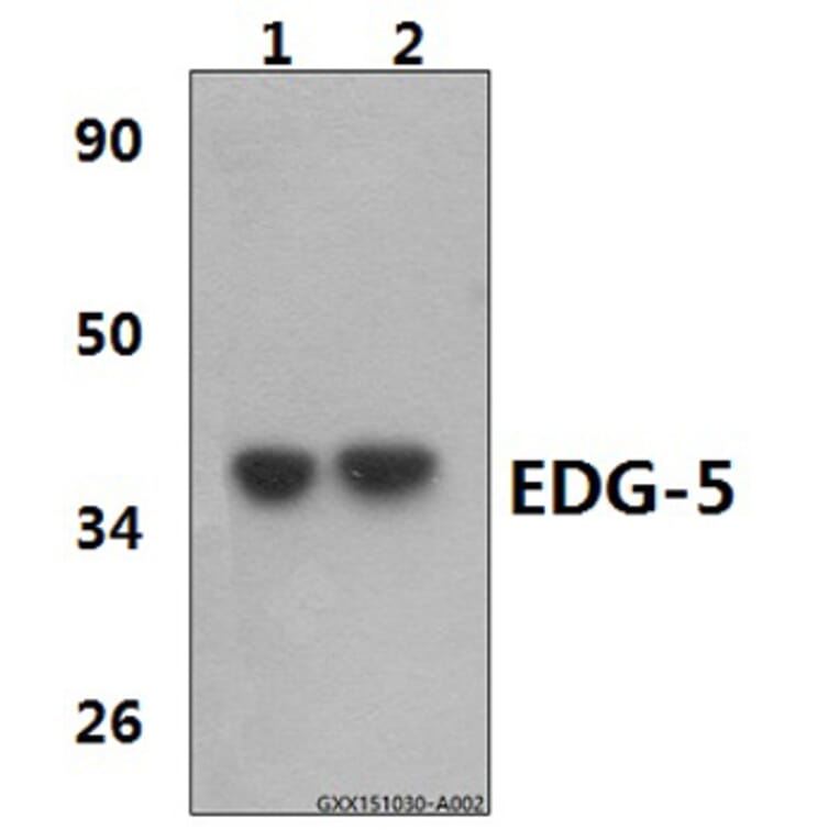 Anti-EDG-5 (L303) Antibody from Bioworld Technology (BS2594) - Antibodies.com