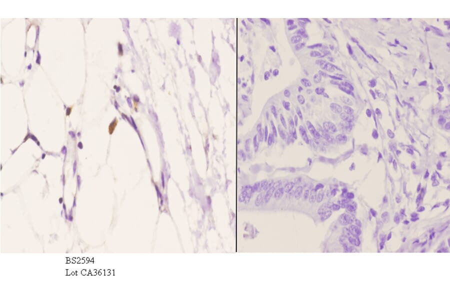 Anti-EDG-5 (L303) Antibody from Bioworld Technology (BS2594) - Antibodies.com