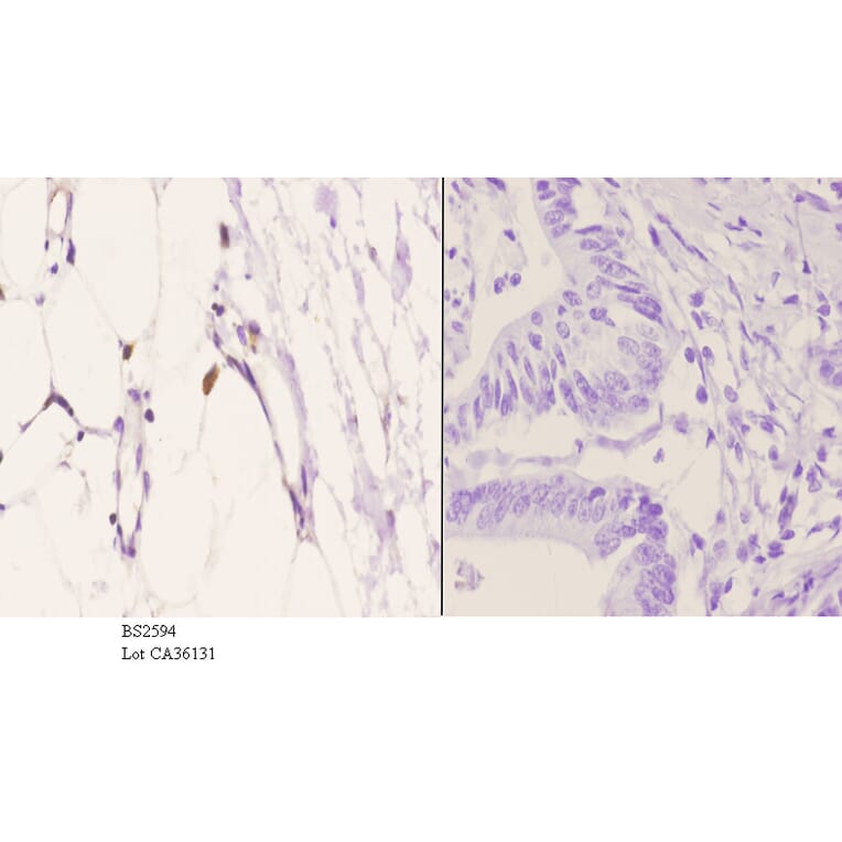Anti-EDG-5 (L303) Antibody from Bioworld Technology (BS2594) - Antibodies.com