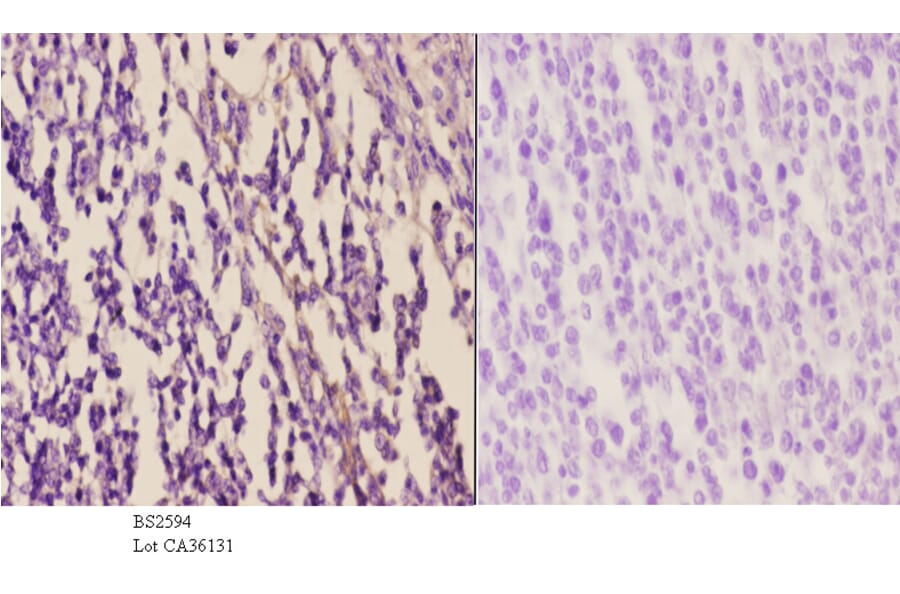 Anti-EDG-5 (L303) Antibody from Bioworld Technology (BS2594) - Antibodies.com
