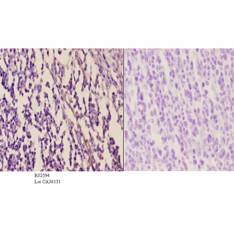 Anti-EDG-5 (L303) Antibody from Bioworld Technology (BS2594) - Antibodies.com