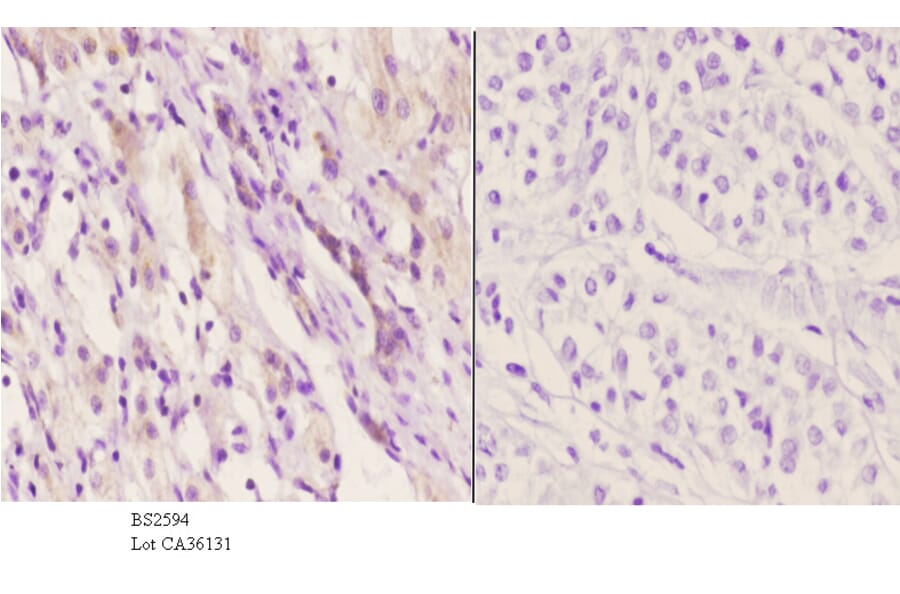 Anti-EDG-5 (L303) Antibody from Bioworld Technology (BS2594) - Antibodies.com