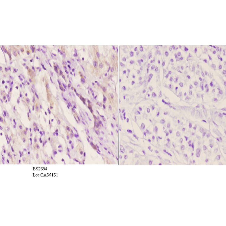 Anti-EDG-5 (L303) Antibody from Bioworld Technology (BS2594) - Antibodies.com