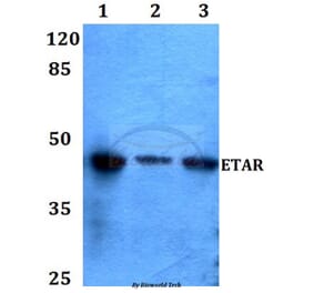 Anti-ETAR (N427) Antibody from Bioworld Technology (BS2597) - Antibodies.com